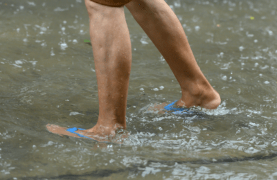 353 kaso ng leptospirosis, naitala sa JBLMGH